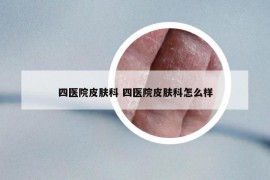 四医院皮肤科 四医院皮肤科怎么样