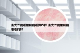 吉大二院看银屑病看得咋样 吉大二院银屑病谁看的好