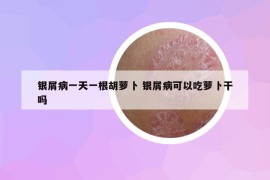 银屑病一天一根胡萝卜 银屑病可以吃萝卜干吗