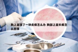 胸上面涨了一块皮癣怎么办 胸部上面长癣怎么回事