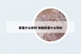 藓是什么样的 体股藓是什么样的