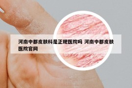 河南中都皮肤科是正规医院吗 河南中都皮肤医院官网