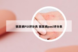 银屑病PSI评分表 银屑病pasi评分表