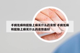 手腕处癣和屁股上癣买什么药膏擦 手腕处癣和屁股上癣买什么药膏擦最好