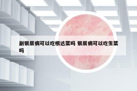 副银屑病可以吃根达菜吗 银屑病可以吃生菜吗