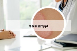 牛皮癣治疗ppt