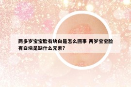 两多岁宝宝脸有块白是怎么回事 两岁宝宝脸有白块是缺什么元素?