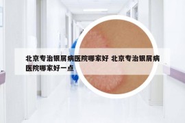 北京专治银屑病医院哪家好 北京专治银屑病医院哪家好一点