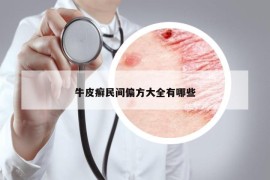 牛皮癣民间偏方大全有哪些