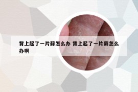 背上起了一片藓怎么办 背上起了一片藓怎么办啊