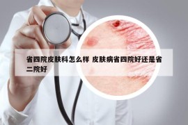 省四院皮肤科怎么样 皮肤病省四院好还是省二院好