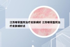 江苏哪家医院治疗皮肤病好 江苏哪家医院治疗皮肤病好点