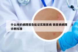 什么样的病理报告能证实银屑病 银屑病病理诊断标准