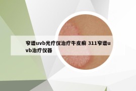 窄谱uvb光疗仪治疗牛皮癣 311窄谱uvb治疗仪器