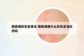 银屑病抗生素用法 银屑病用什么抗生素消炎药吗