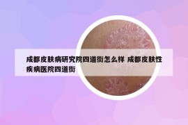 成都皮肤病研究院四道街怎么样 成都皮肤性疾病医院四道街