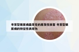 寻常型银屑病最常见的原发性损害 寻常型银屑病的特征性表现为