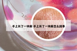 手上长了一块癣 手上长了一块癣怎么回事