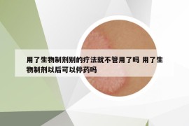 用了生物制剂别的疗法就不管用了吗 用了生物制剂以后可以停药吗