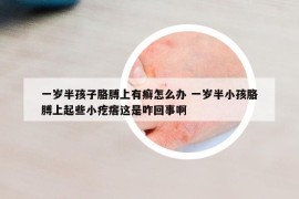 一岁半孩子胳膊上有癣怎么办 一岁半小孩胳膊上起些小疙瘩这是咋回事啊