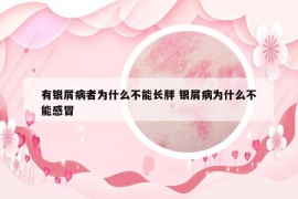 有银屑病者为什么不能长胖 银屑病为什么不能感冒