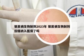 银屑病生物制剂2023年 银屑病生物制剂价格纳入医保了吗