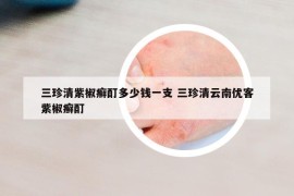 三珍清紫椒癣酊多少钱一支 三珍清云南优客紫椒癣酊