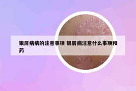 银屑病病的注意事项 银屑病注意什么事项和药