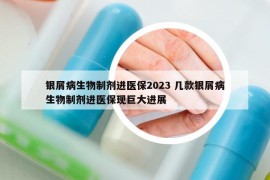 银屑病生物制剂进医保2023 几款银屑病生物制剂进医保现巨大进展