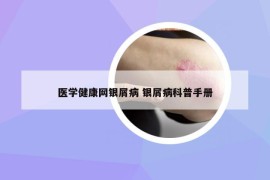 医学健康网银屑病 银屑病科普手册