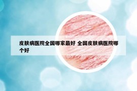 皮肤病医院全国哪家最好 全国皮肤病医院哪个好