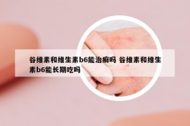 谷维素和维生素b6能治癣吗 谷维素和维生素b6能长期吃吗