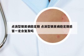 点滴型银屑病稳定期 点滴型银屑病稳定期感冒一定会复发吗