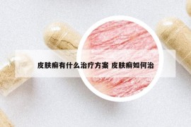 皮肤癣有什么治疗方案 皮肤癣如何治