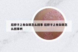 后脖子上有白斑怎么回事 后脖子上有白斑怎么回事啊