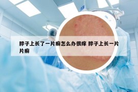 脖子上长了一片癣怎么办很痒 脖子上长一片片癣