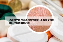 上海哪个医院可以打生物制剂 上海哪个医院可以打生物制剂的针