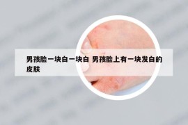 男孩脸一块白一块白 男孩脸上有一块发白的皮肤