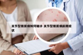 关节型银屑病如何确诊 关节型银屑病前期症状