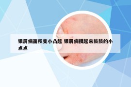 银屑病面积变小凸起 银屑病摸起来鼓鼓的小点点