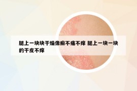 腿上一块块干燥像癣不痛不痒 腿上一块一块的干皮不痒