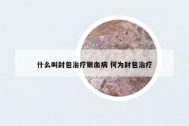 什么叫封包治疗银血病 何为封包治疗