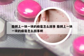 胳膊上一块一块的癣是怎么回事 胳膊上一块一块的癣是怎么回事啊