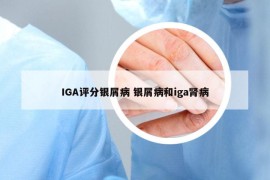 IGA评分银屑病 银屑病和iga肾病