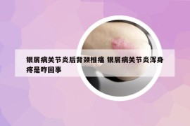 银屑病关节炎后背颈椎痛 银屑病关节炎浑身疼是咋回事