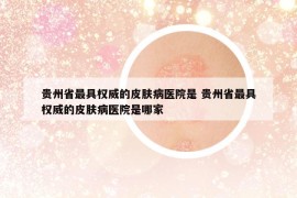 贵州省最具权威的皮肤病医院是 贵州省最具权威的皮肤病医院是哪家