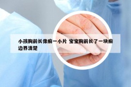 小孩胸前长像癣一小片 宝宝胸前长了一块癣边界清楚