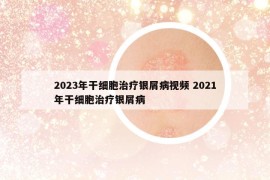 2023年干细胞治疗银屑病视频 2021年干细胞治疗银屑病