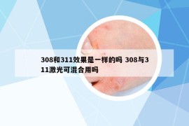 308和311效果是一样的吗 308与311激光可混合用吗