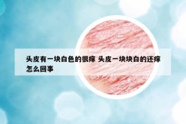 头皮有一块白色的很痒 头皮一块块白的还痒怎么回事